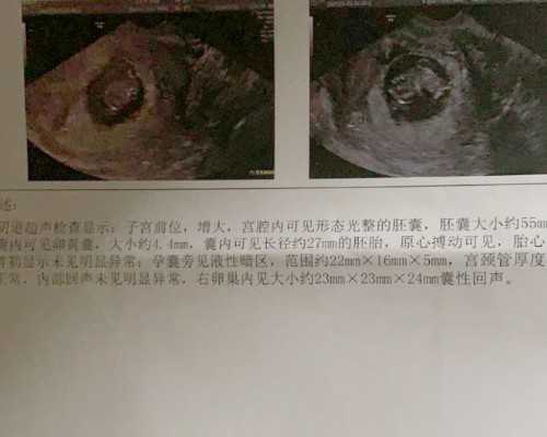 上海全包代孕套餐,上海九院做试管婴儿全部费用